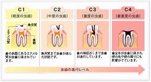 歯科医院でクリーニングを受ける頻度について